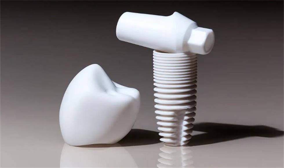 Ceramic Dental Implants