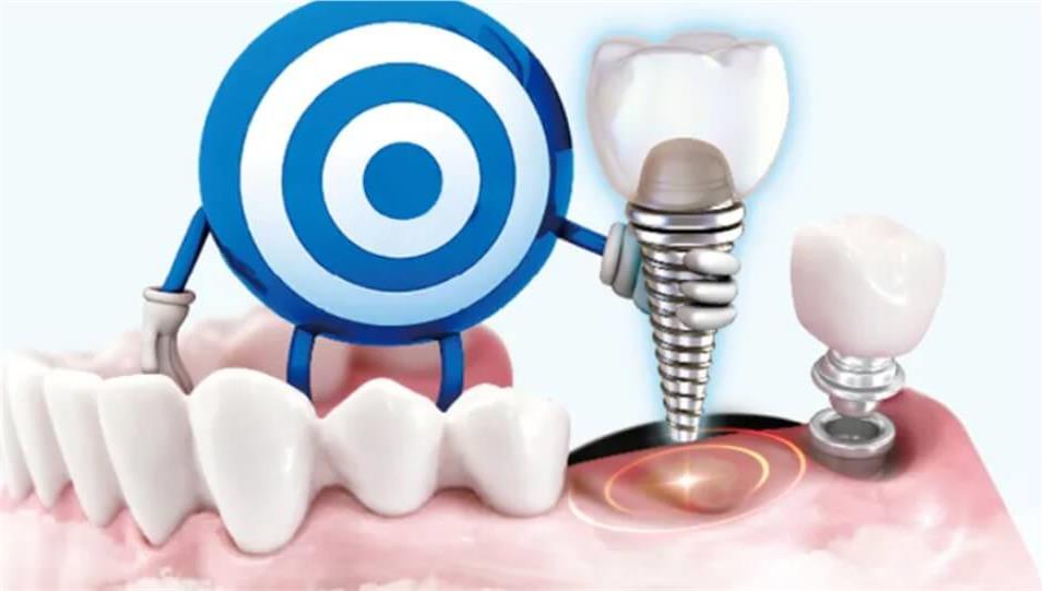 what are teeth implants made of